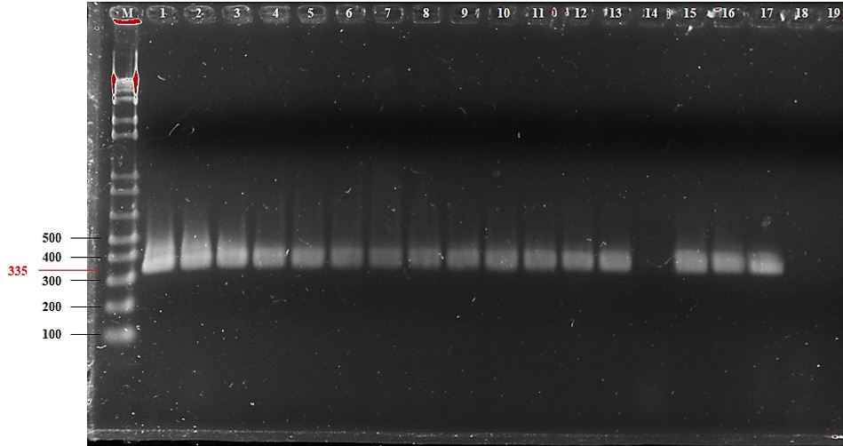 Productos de amplificación de los cebadores específicos MpKF1 y MpKR1 para la identificación de M. phaseolina. M: marcador de peso molecular, en pares de bases. 1 al 17: aislados de M. phaseolina. 18: control negativo, DNA de Aspergillussp. 19: control negativo, mix + agua. CEMIT-UNA. San Lorenzo, Paraguay. 2022.